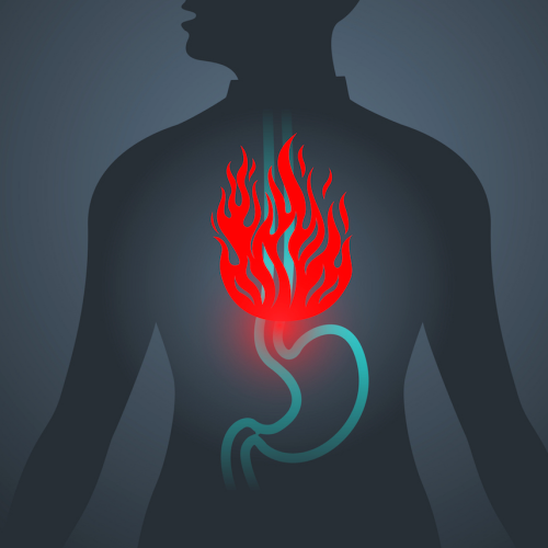 Heartburn Xtreme (image for) Heartburn Xtreme