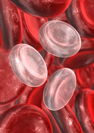 Iron Up (image for) Iron Up